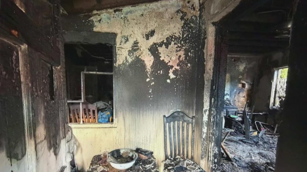 Woman hospitalized after Miami house fire leaves three displaced — CBS Miami, Hillsborough Health news
